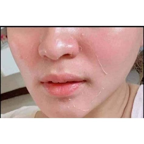 Sabon na Nakakaputi at Nakakatangal ng Peklat kahit in just 20 .